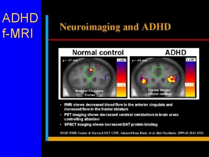 ADHD f-MRI 