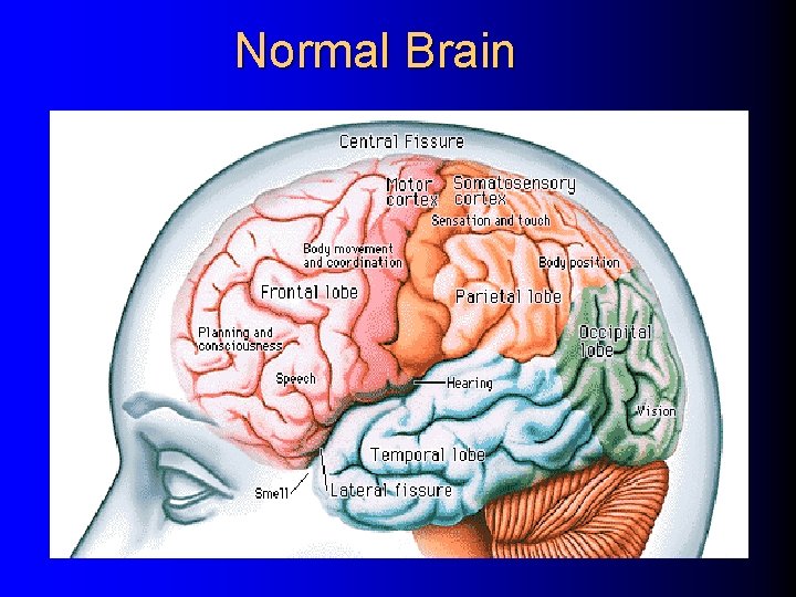 Normal Brain 