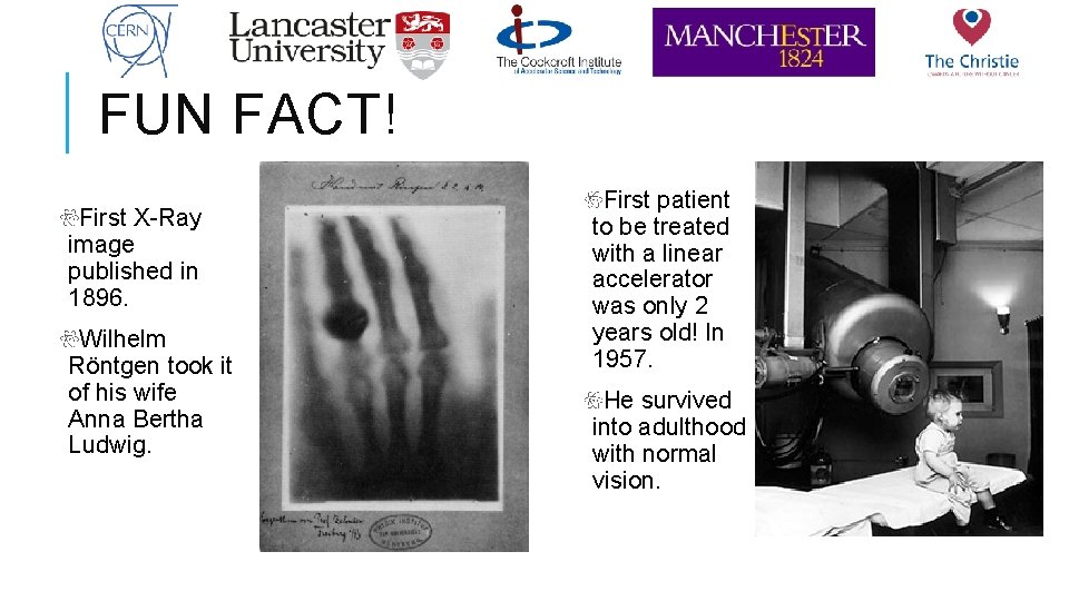 FUN FACT! First X-Ray image published in 1896. Wilhelm Röntgen took it of his