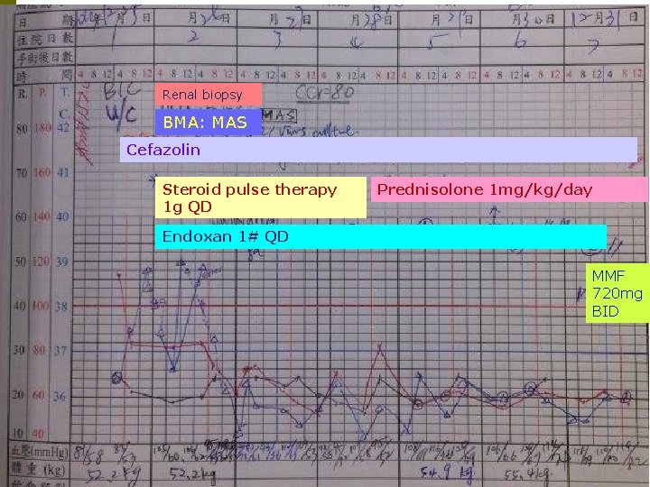 Renal biopsy BMA: MAS Cefazolin Steroid pulse therapy 1 g QD Prednisolone 1 mg/kg/day