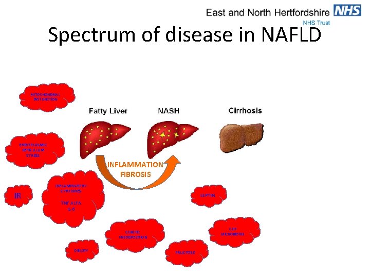 Spectrum of disease in NAFLD MITOCHONDRIAL DYSFUNCTION ENDOPLASMIC RETICULUM STRESS INFLAMMATION FIBROSIS IR INFLAMMATORY