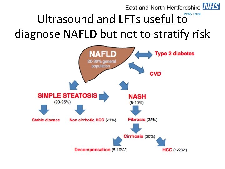 Ultrasound and LFTs useful to diagnose NAFLD but not to stratify risk 