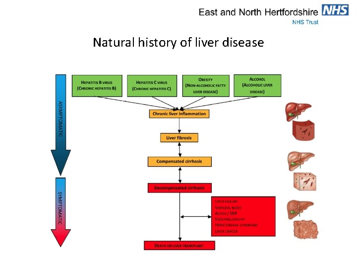 Natural history of liver disease 