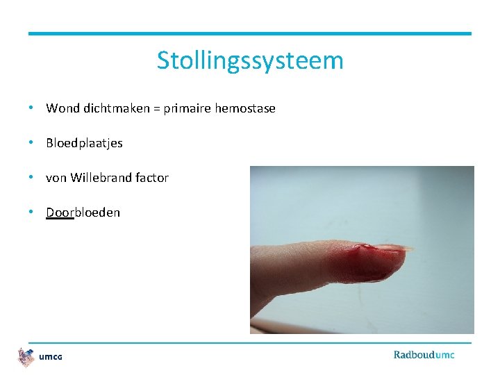 Stollingssysteem • Wond dichtmaken = primaire hemostase • Bloedplaatjes • von Willebrand factor •