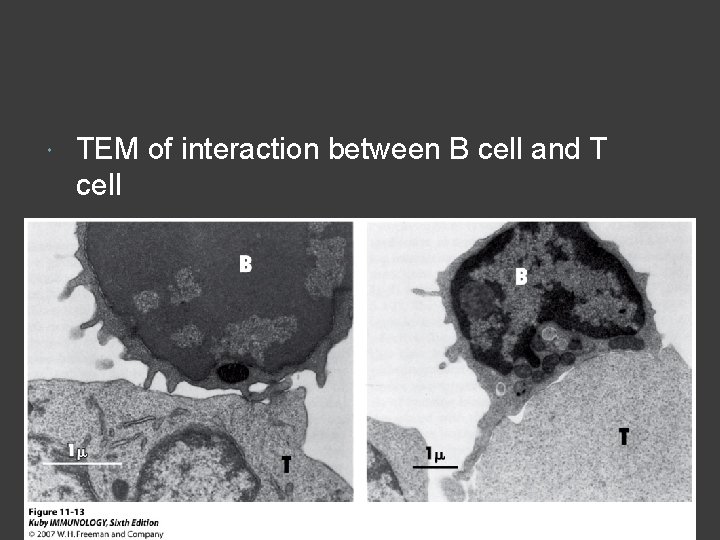  TEM of interaction between B cell and T cell 
