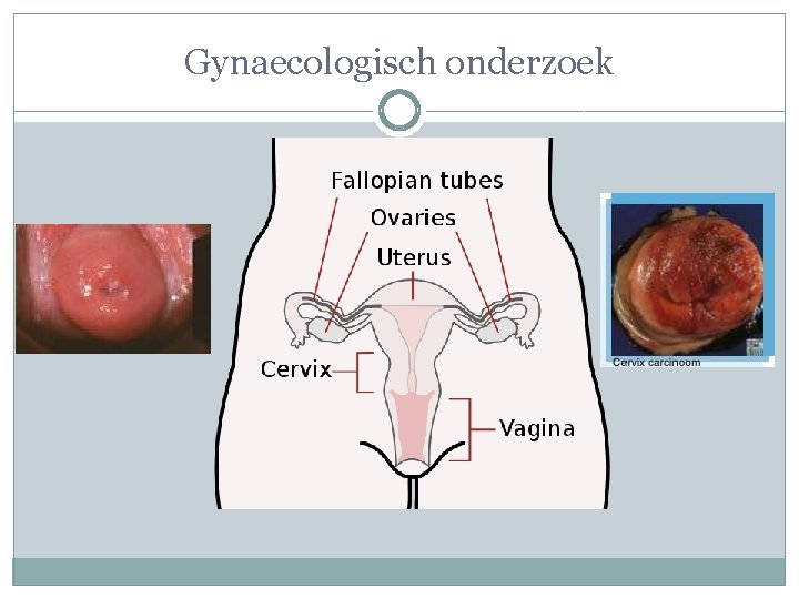 Gynaecologisch onderzoek 