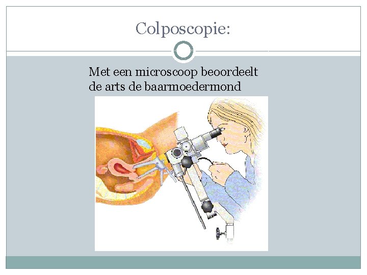 Colposcopie: Met een microscoop beoordeelt de arts de baarmoedermond 