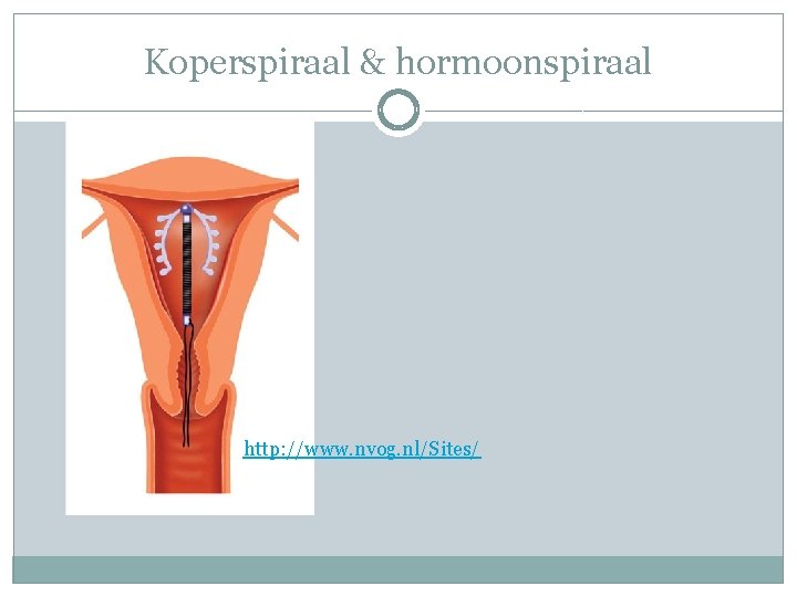 Koperspiraal & hormoonspiraal http: //www. nvog. nl/Sites/ 