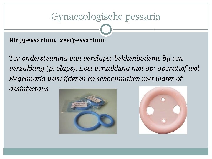 Gynaecologische pessaria Ringpessarium, zeefpessarium Ter ondersteuning van verslapte bekkenbodems bij een verzakking (prolaps). Lost