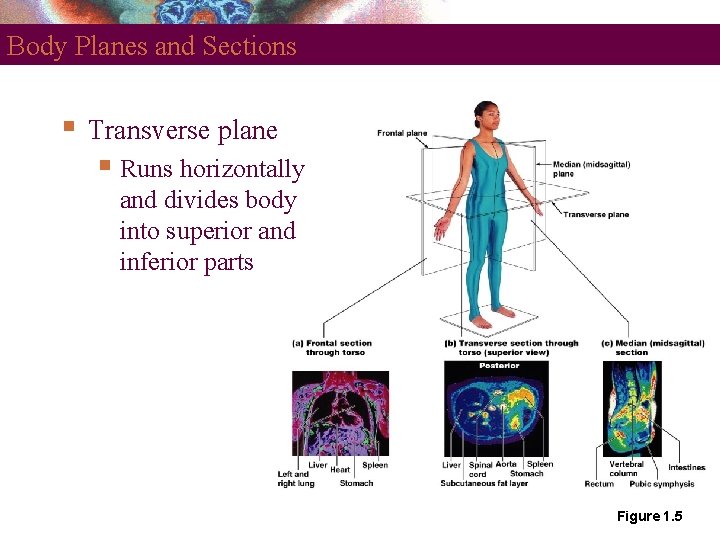 Body Planes and Sections Transverse plane Runs horizontally and divides body into superior and