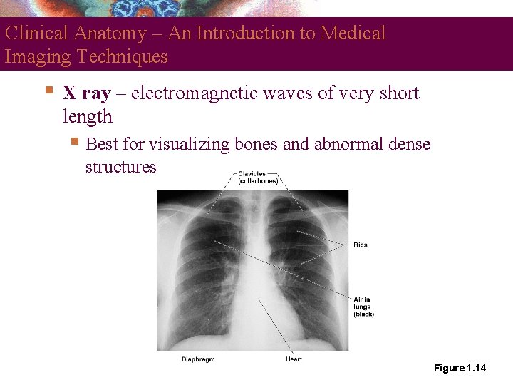 Clinical Anatomy – An Introduction to Medical Imaging Techniques X ray – electromagnetic waves