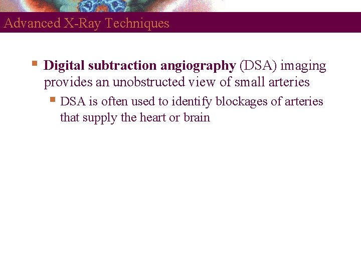 Advanced X-Ray Techniques Digital subtraction angiography (DSA) imaging provides an unobstructed view of small