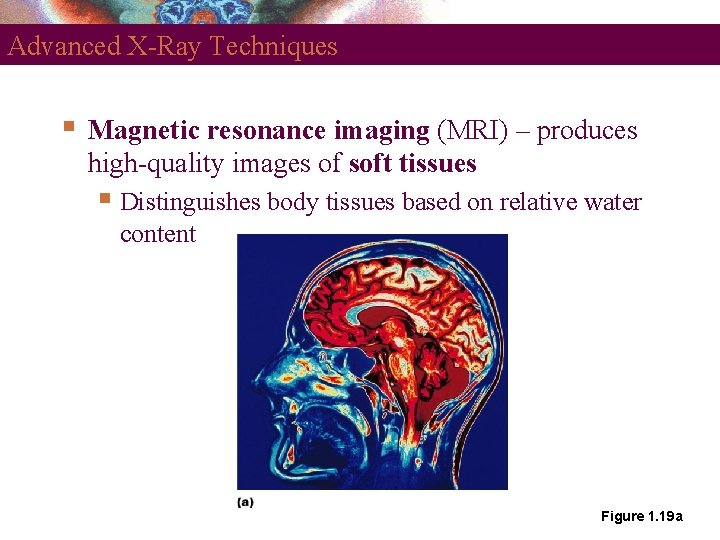 Advanced X-Ray Techniques Magnetic resonance imaging (MRI) – produces high-quality images of soft tissues