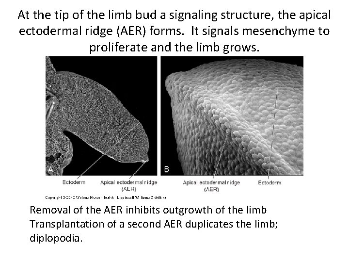 At the tip of the limb bud a signaling structure, the apical ectodermal ridge