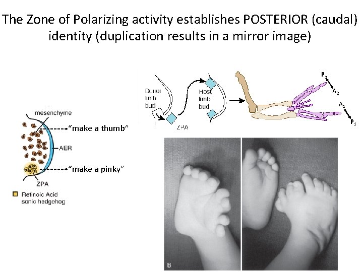 The Zone of Polarizing activity establishes POSTERIOR (caudal) identity (duplication results in a mirror