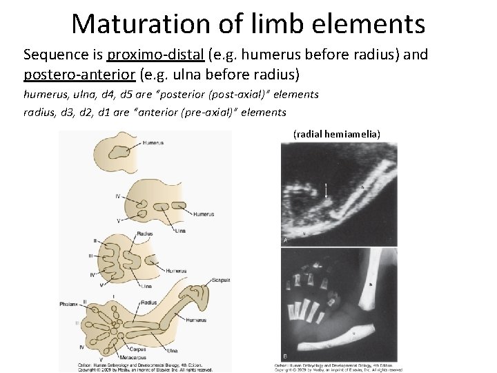 Maturation of limb elements Sequence is proximo-distal (e. g. humerus before radius) and postero-anterior