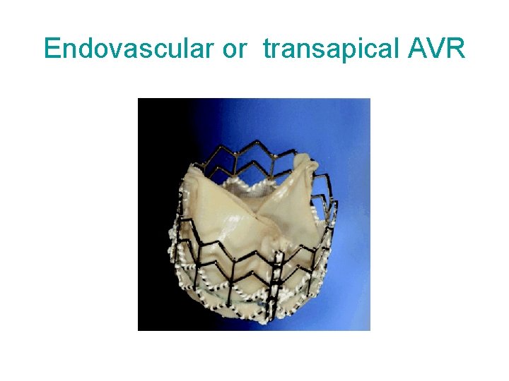 Endovascular or transapical AVR 