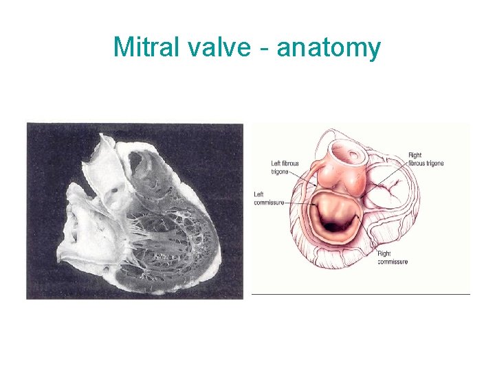 Mitral valve - anatomy 