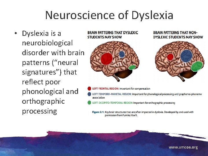 Neuroscience of Dyslexia • Dyslexia is a neurobiological disorder with brain patterns (“neural signatures”)