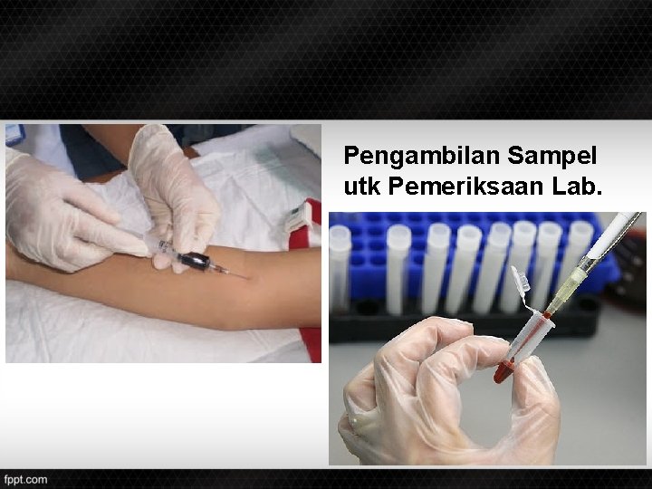 Pengambilan Sampel utk Pemeriksaan Lab. 