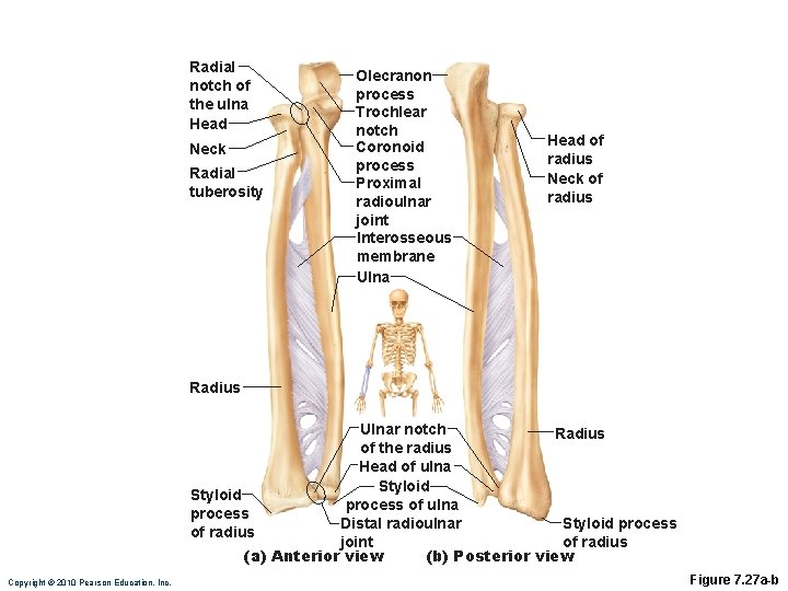 Radial notch of the ulna Head Neck Radial tuberosity Olecranon process Trochlear notch Coronoid