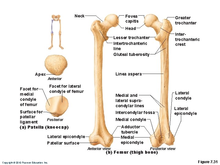 Neck Fovea capitis Greater trochanter Head Intertrochanteric crest Lesser trochanter Intertrochanteric line Gluteal tuberosity