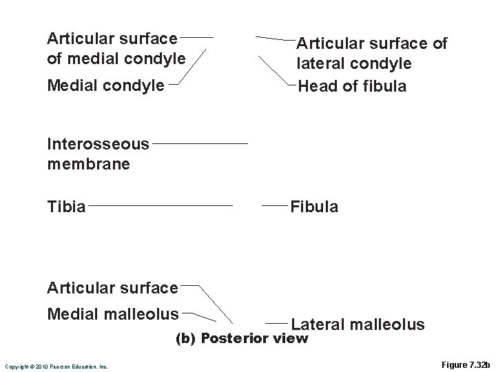 Articular surface of medial condyle Medial condyle Articular surface of lateral condyle Head of