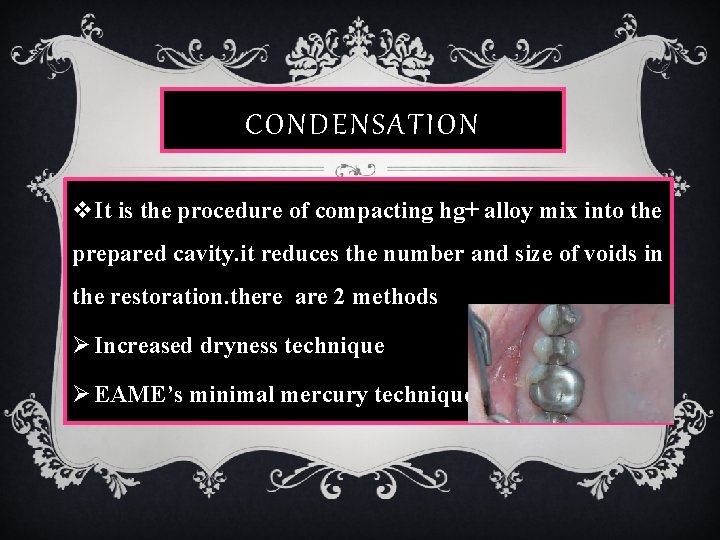 CONDENSATION v. It is the procedure of compacting hg+ alloy mix into the prepared