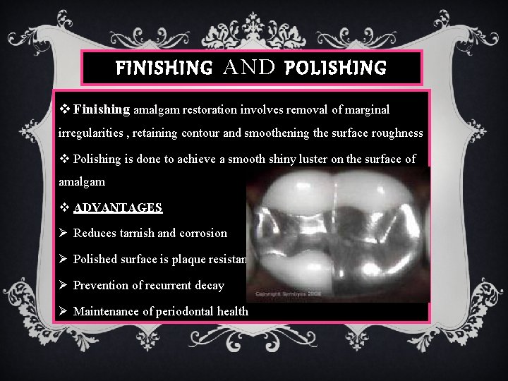 FINISHING AND POLISHING v Finishing amalgam restoration involves removal of marginal irregularities , retaining