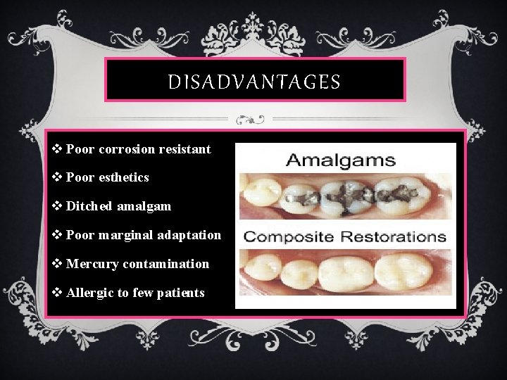 DISADVANTAGES v Poor corrosion resistant v Poor esthetics v Ditched amalgam v Poor marginal