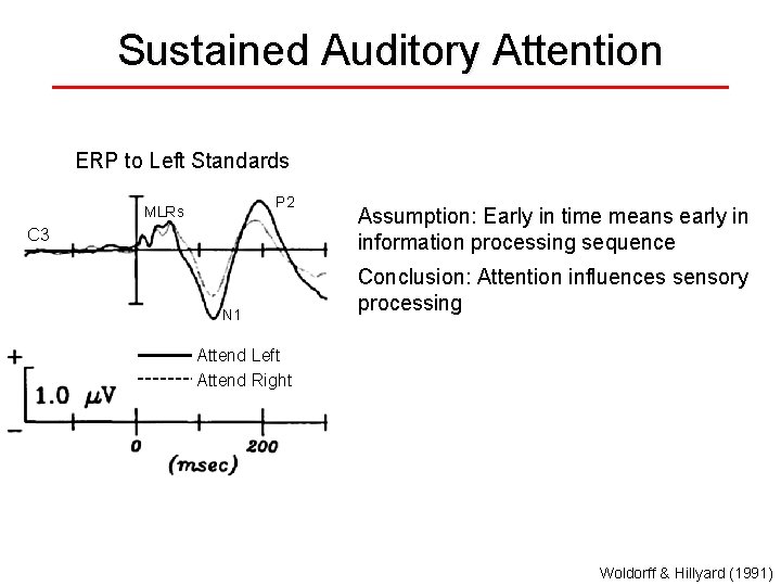 Sustained Auditory Attention ERP to Left Standards P 2 MLRs C 3 N 1