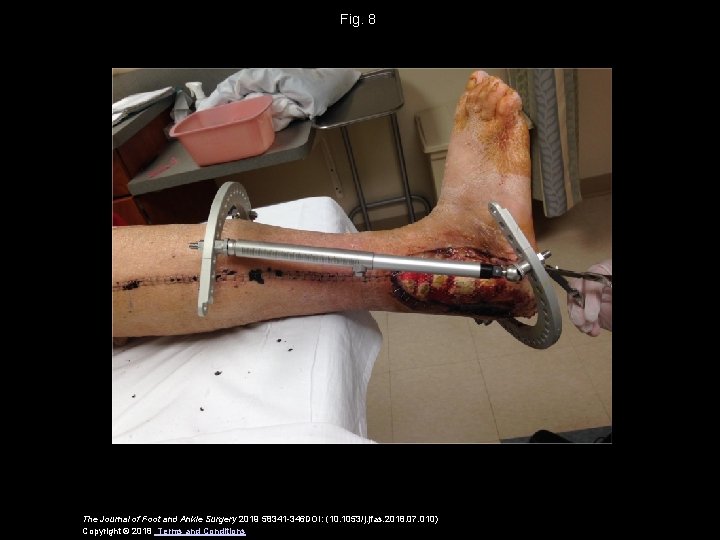 Fig. 8 The Journal of Foot and Ankle Surgery 2019 58341 -346 DOI: (10.