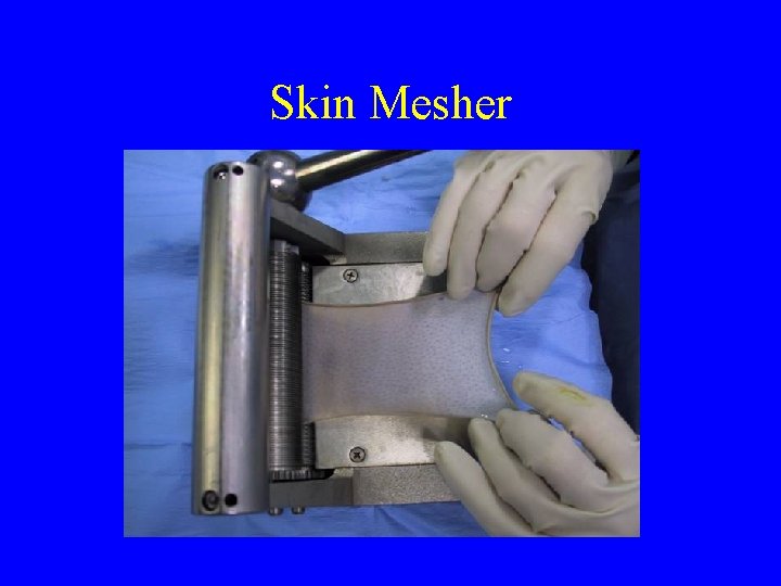 Skin Mesher 