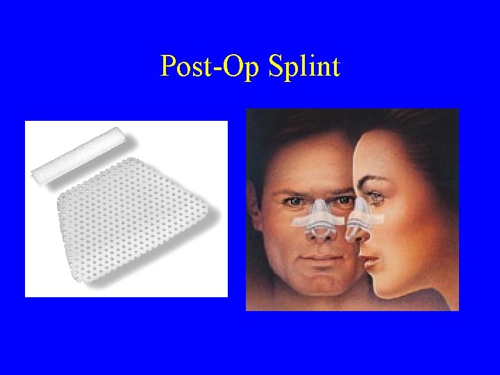 Post-Op Splint 