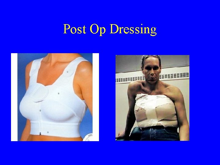 Post Op Dressing 