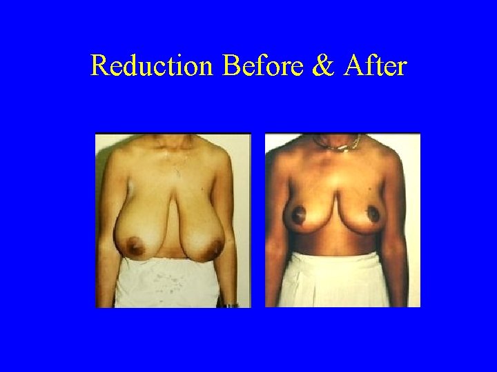 Reduction Before & After 