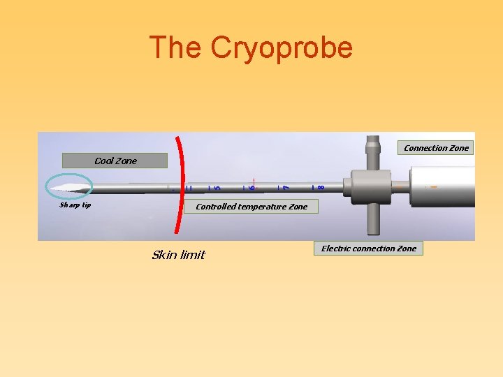 The Cryoprobe Connection Zone Cool Zone Sharp tip Controlled temperature Zone Skin limit Electric