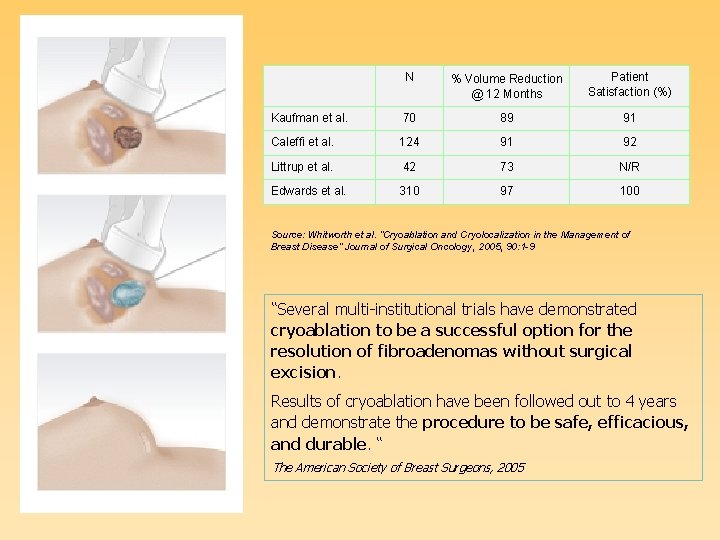 N % Volume Reduction @ 12 Months Patient Satisfaction (%) Kaufman et al. 70