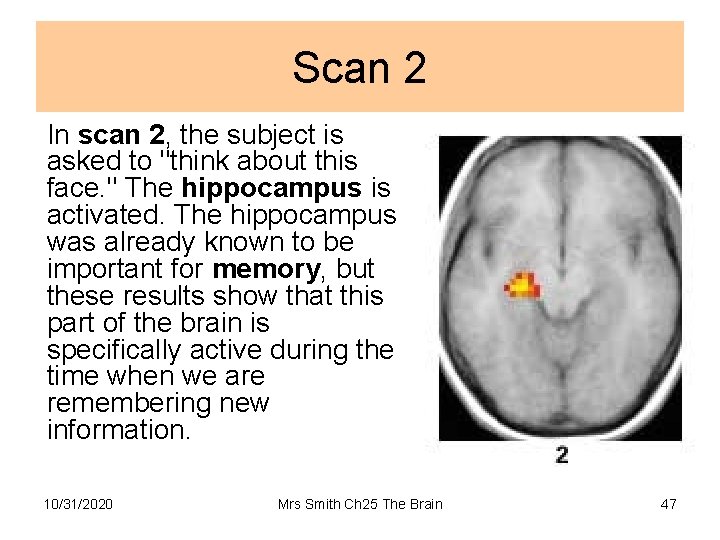 Scan 2 In scan 2, the subject is asked to "think about this face.