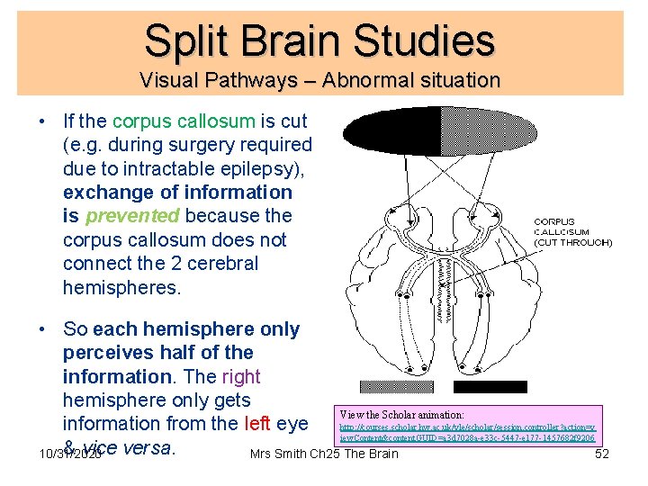 Split Brain Studies Visual Pathways – Abnormal situation • If the corpus callosum is