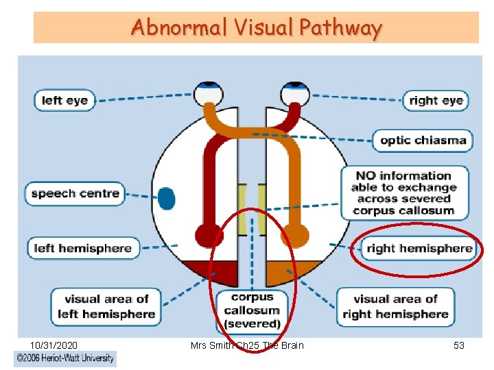 Abnormal Visual Pathway 10/31/2020 Mrs Smith Ch 25 The Brain 53 