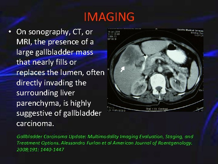 IMAGING • On sonography, CT, or MRI, the presence of a large gallbladder mass