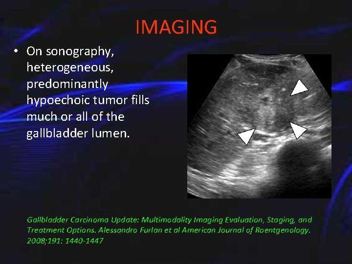 IMAGING • On sonography, heterogeneous, predominantly hypoechoic tumor fills much or all of the