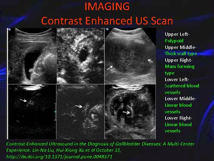 IMAGING Contrast Enhanced US Scan Upper Left. Polypoid Upper Middle. Thick wall type Upper