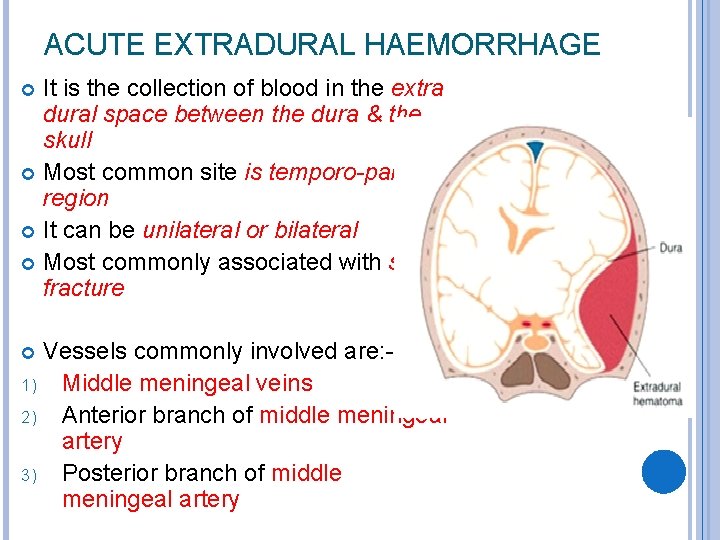 ACUTE EXTRADURAL HAEMORRHAGE It is the collection of blood in the extra dural space
