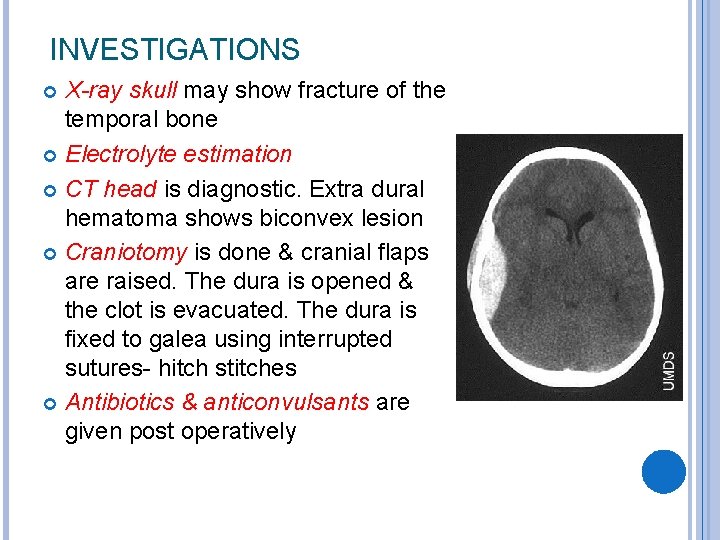 INVESTIGATIONS X-ray skull may show fracture of the temporal bone Electrolyte estimation CT head