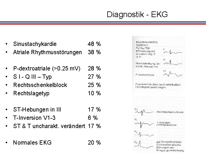 Diagnostik - EKG • Sinustachykardie 48 % • Atriale Rhythmusstörungen 38 % • •