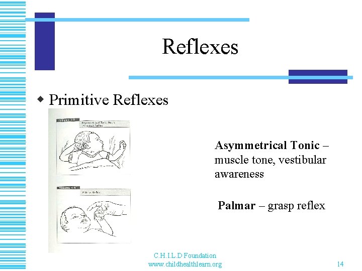 Reflexes w Primitive Reflexes Asymmetrical Tonic – muscle tone, vestibular awareness Palmar – grasp