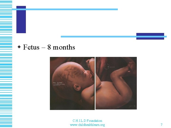 w Fetus – 8 months C. H. I. L. D Foundation www. childhealthlearn. org