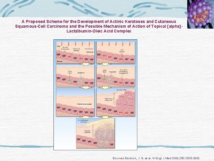 A Proposed Scheme for the Development of Actinic Keratoses and Cutaneous Squamous-Cell Carcinoma and